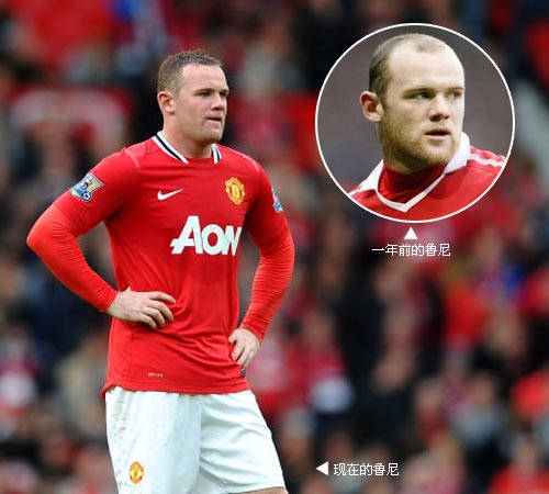 明星心聲:植發(fā)了被別人嘲笑也是快樂的