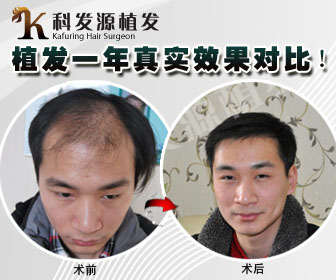 科發源植發長沙分院即將盛大開業