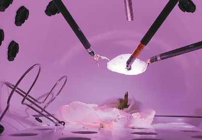 國產醫療器械后發快跑